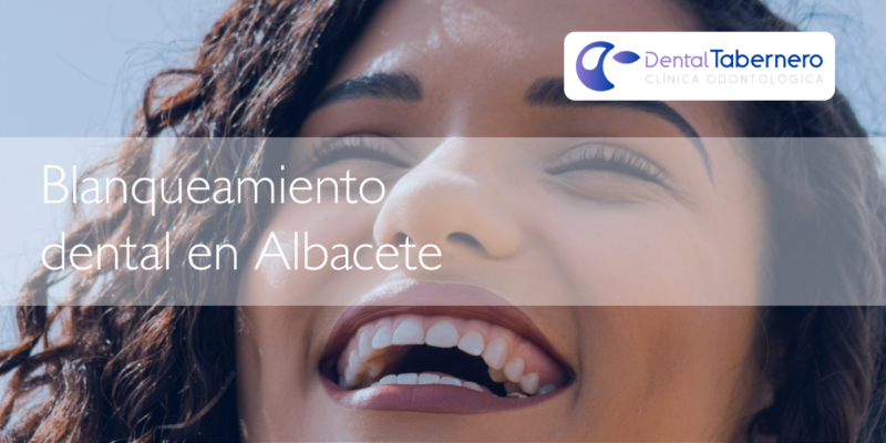 Blanqueamiento dental en albacete Blanqueamiento dental en albacete