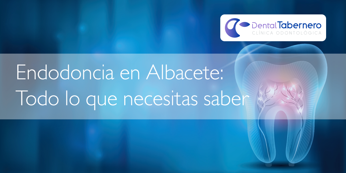 Endodoncia en Albacete Endodoncia en Albacete