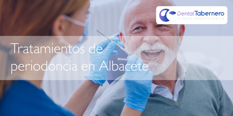 Tratamientos de periodoncia en albacete Tratamientos de periodoncia en albacete