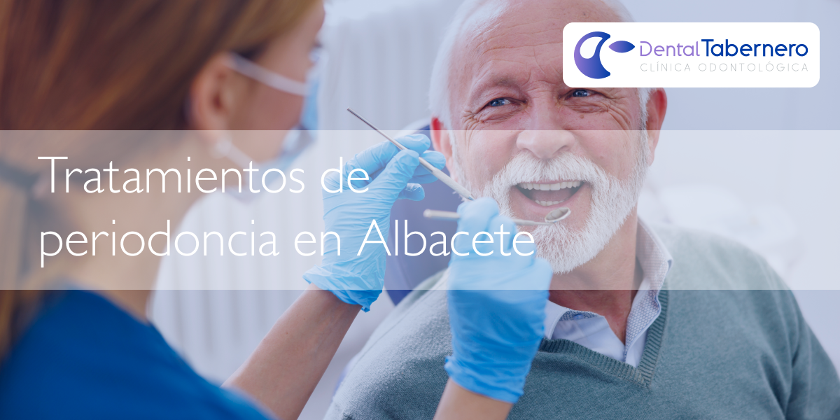 Tratamientos de periodoncia en albacete Tratamientos de periodoncia en albacete